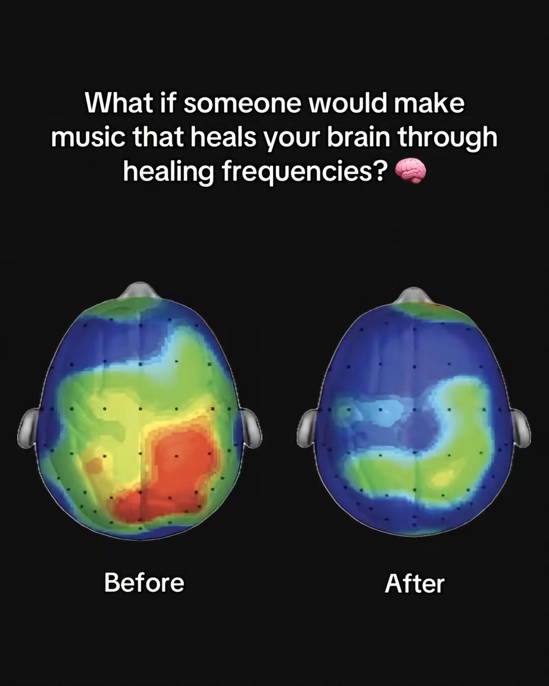 What if someone would make music that heals your brain through healing frequencies?
