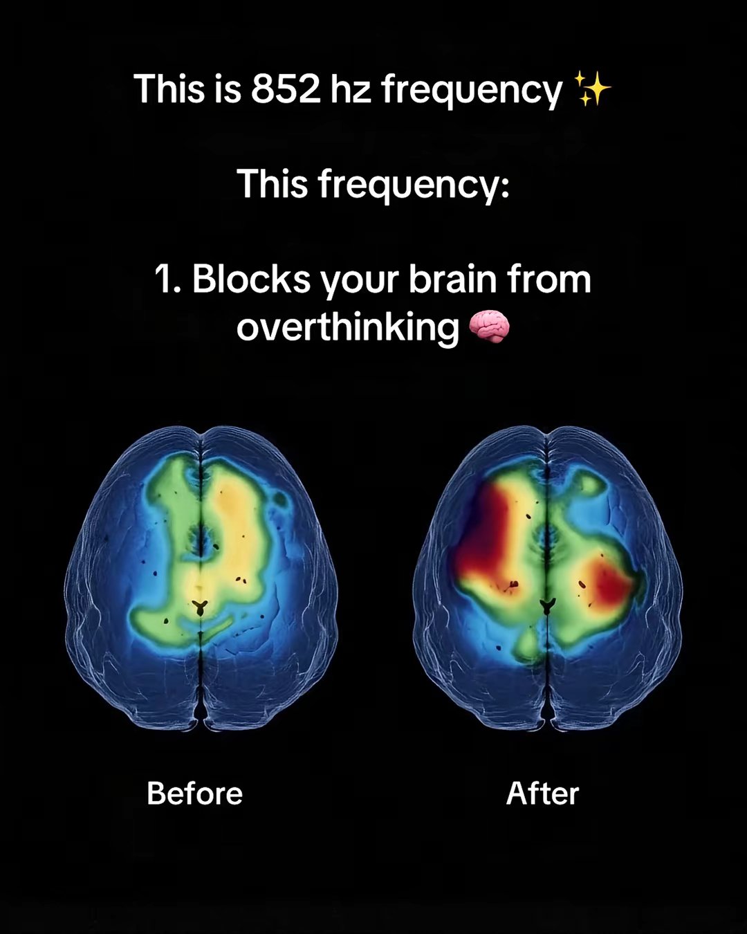 This is 852 hz frequency ✨ This frequency: 1. Blocks your brain from overthinking 🧠
